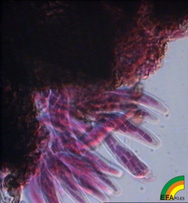 Mycosphaerella - Ascas y ascosporas de Mycosphaerella.jpg